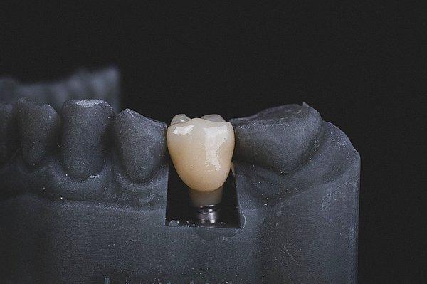 7. "Dişçilik fakültesi anatomi laboratuvarında öğrenciler olarak birinin boğazını kesiyorduk..."