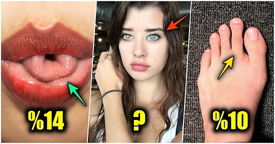 Bakalım Siz Ne Kadar Özelsiniz! Sadece Doğuştan Gelen ve Toplumda Oldukça Nadir Görülen 25 Genetik Özellik