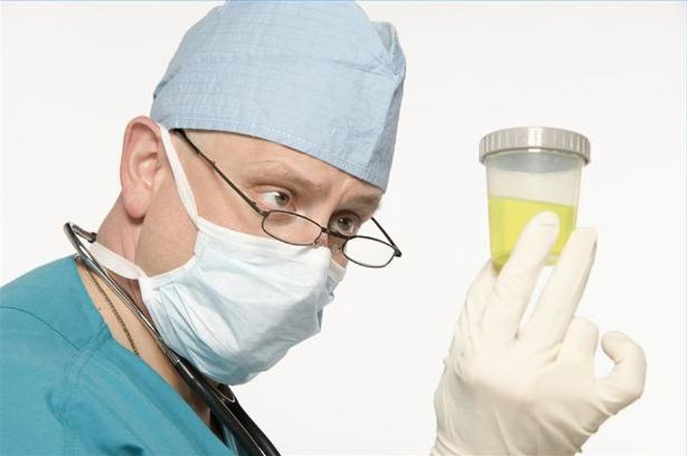 UBG: Ürobilinojen Nedir? Yüksekliği ve Düşüklüğü Ne Anlamlara Gelir? Değerleri Kaç Olmalıdır?