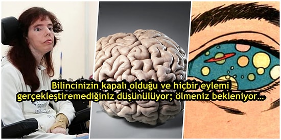 İnsanı Beynine Hapsedip, Ölümü Bekleten Tüyler Ürpertici Bir Hastalık: Locked-in Sendromu