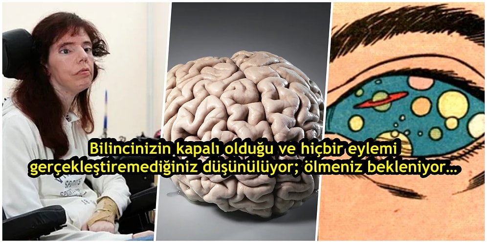 İnsanı Beynine Hapsedip, Ölümü Bekleten Tüyler Ürpertici Bir Hastalık: Locked-in Sendromu