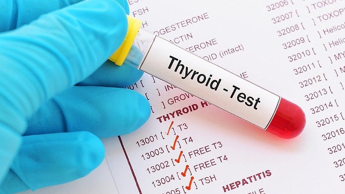 T3- T4 Tiroid Fonksiyonları Nedir? Yüksekliği ve Düşüklüğü Ne Anlama Gelir? Değerleri Kaç Olmalıdır?
