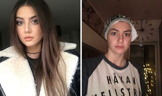 18 фотографий реальной красоты, которые сильно контрастируют с фотошопом в Инстаграме