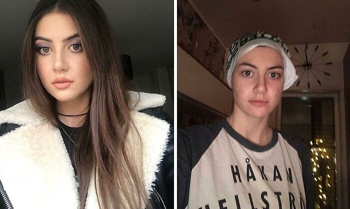 18 фотографий реальной красоты, которые сильно контрастируют с фотошопом в Инстаграме