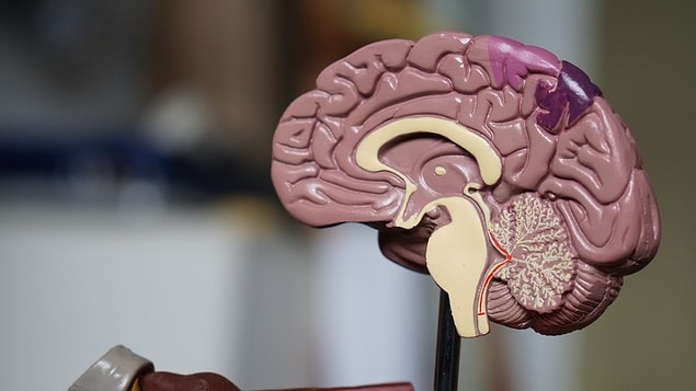 Bilim insanları 58 yaşında görme engelli bir kadının beynindeki görme merkezine yerleştirdikleri beyin implantı ile basit şekilleri görmesini sağladılar.