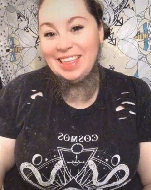 OnlyFans platformunda da aktif olan genç kadın kendisini 'gerçek sakallı çılgın' ve 'kıllı, şişman ve güzel' olarak tanımlıyor.