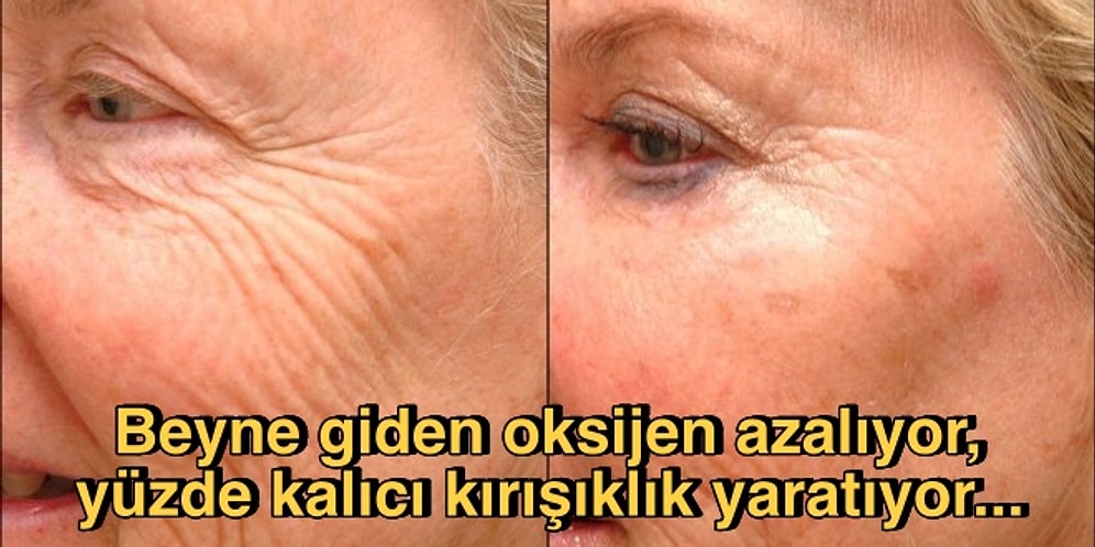 Biliyoruz Başka Şekilde Uyuyamıyorsunuz Ancak Yüzüstü Uyumanın Sonuçlarını Ciddiye Almazsak Çok Geç Kalacağız