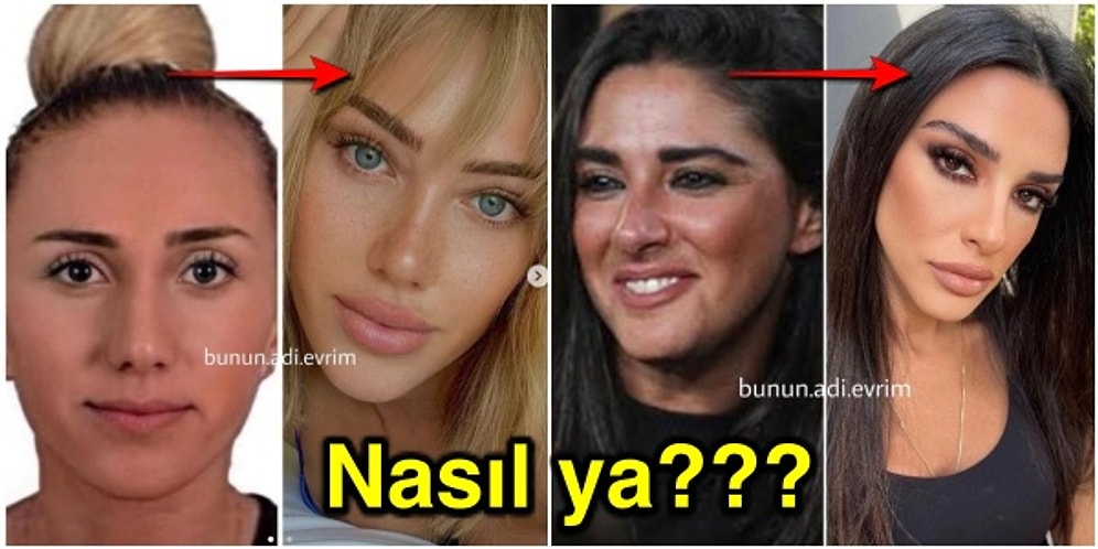 Değişim Yerine Evrim Geçirerek İnsanı Şoklara Sokan Ünlülerin Eski ve Yeni Hallerini Görmeniz Lazım