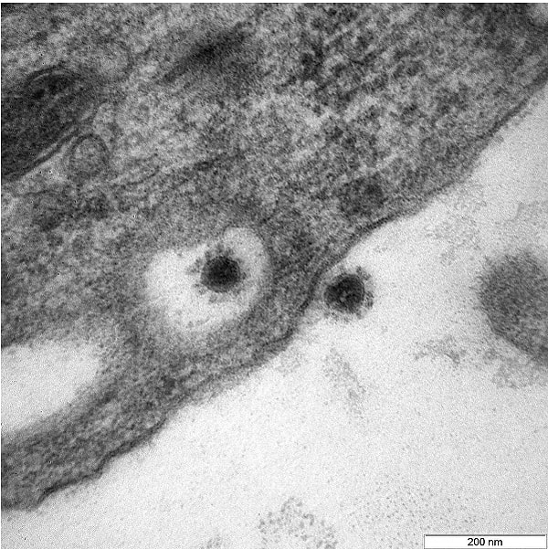 Вирус был искусственно выращен в культуре эпителиальных клеток почки африканской зеленой обезьяны, поясняет центр.