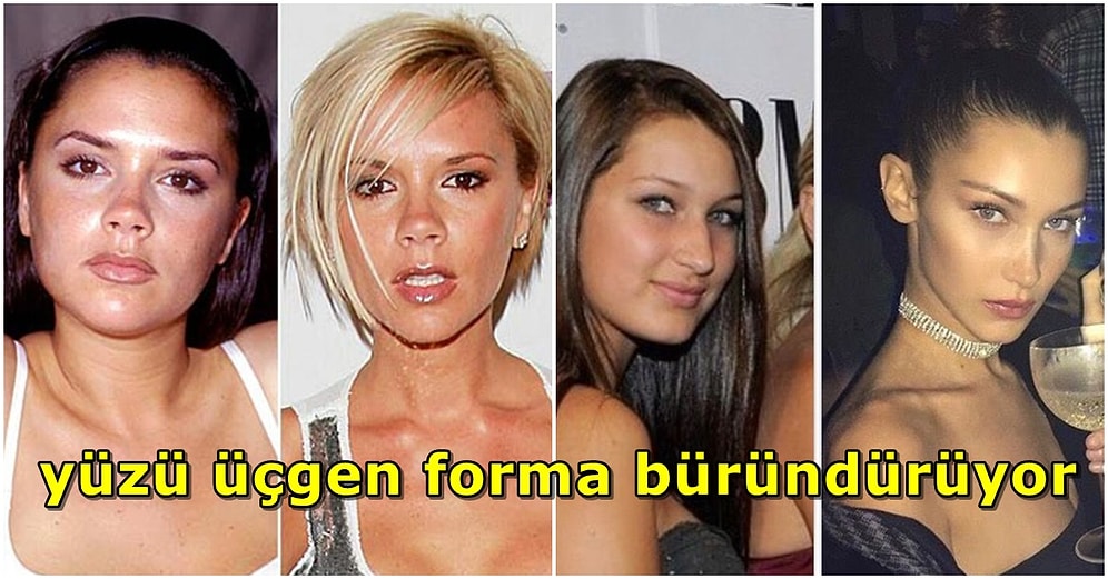 Yaptırmayan Kaldı mı? Bişektomi Ameliyatıyla Ütopik Değişimlere İmza Atan 15 Ünlü