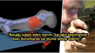 Bacağınızdan Vurulduğunuz Zaman Başınıza Neler Geleceğini Merak Ediyor musunuz?