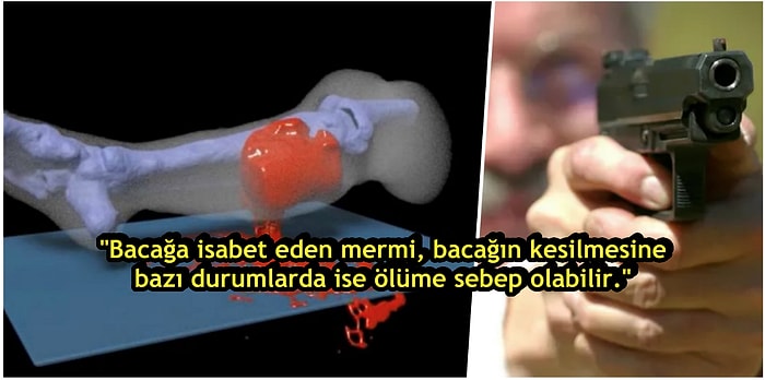 Bacağınızdan Vurulduğunuz Zaman Başınıza Neler Geleceğini Merak Ediyor musunuz?