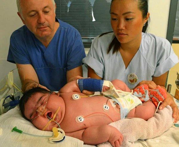 3. Yeni doğan bir bebeğin bu büyüklükte olması normal mi?