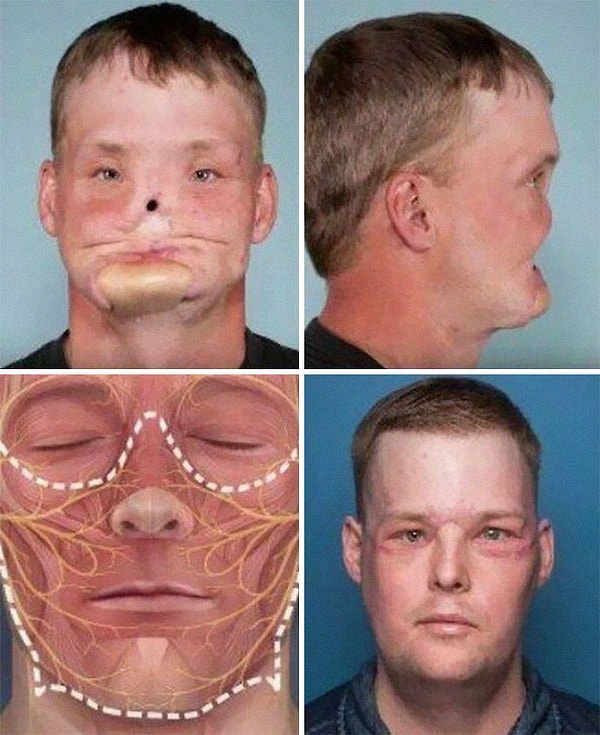 5. Невероятная хорошо выполненная пересадка лица