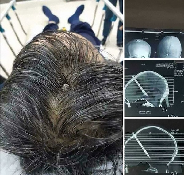 10. Вот почему нужно носить каску