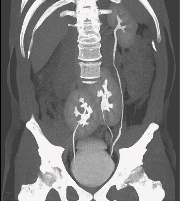 19. У мужчины обнаружены три почки! - Медицинский случай