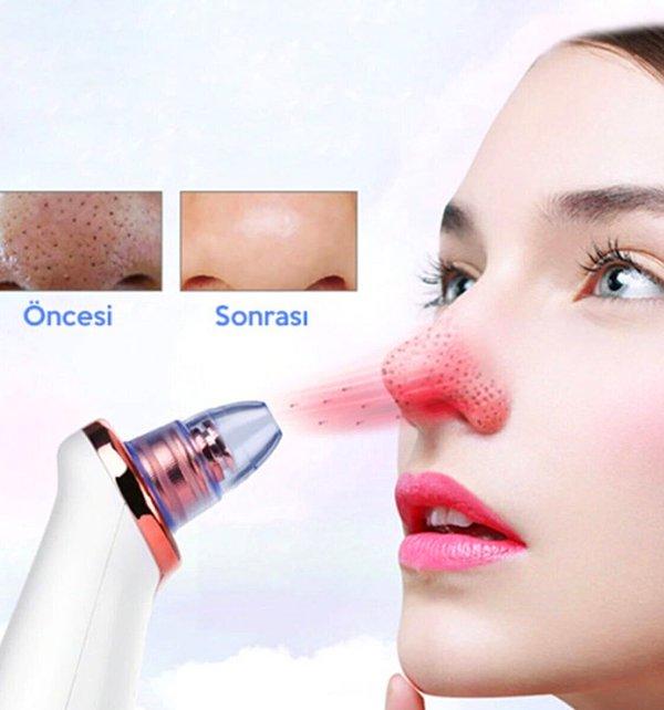 12. Cildinizle ilgili sorun yaşayan biriyseniz vakumlu yüz temizleme cihazını denemelisiniz.
