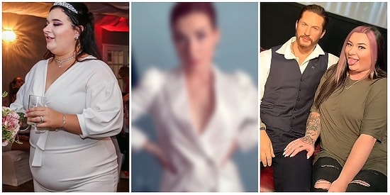 Ucuz ve Başarılı: Türkiye'de Geçirdiği Mide ve Estetik Operasyonlarıyla Büyük Değişim Geçiren İngiliz Kadın