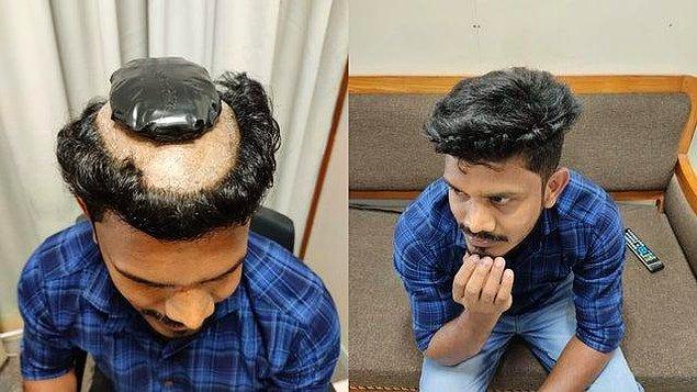 1. The man who tried to smuggle 1 kg gold under his wig at Kochi airport: 😂