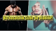 Erkeklerde Yaygın Olan Beden Dismorfik Bozukluğu ve Kas Dismorfisi Nedir?