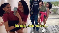 Yapışık İkiz Oldukları İçin Kız Kardeşi ve Sevgilisinin Her Buluşmasında Yer Alan Genç Kızın İlginç Hikayesi