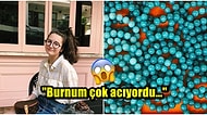 Küçükken Burnunun İçine Kaçırdığı Boncuktan Habersiz 20 Yıl Boyunca Yaşayan Genç Kadının Yaşadığı Şok