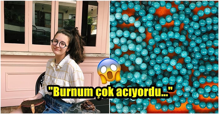 Küçükken Burnunun İçine Kaçırdığı Boncuktan Habersiz 20 Yıl Boyunca Yaşayan Genç Kadının Yaşadığı Şok