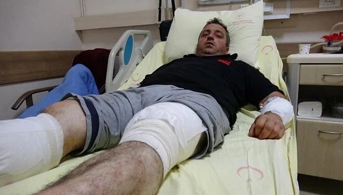 Ayı Saldırısından Güreşerek Kurtuldu: 'Cesaretim Sayesinde Yaşıyorum'