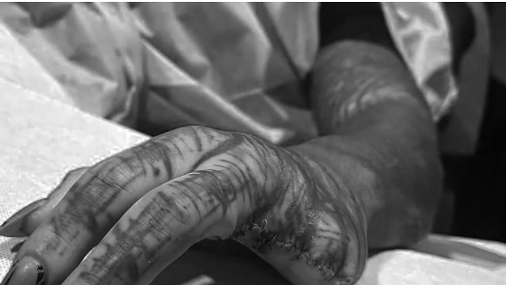 Мужчина отрезал себе пальцы, чтобы выглядеть как инопланетянин: завершено всего 34% трансформации