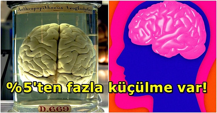 Bilim İnsanları Son 50 Bin Yılda İnsan Beyninin Büyük Ölçüde Küçüldüğünü Açıkladı