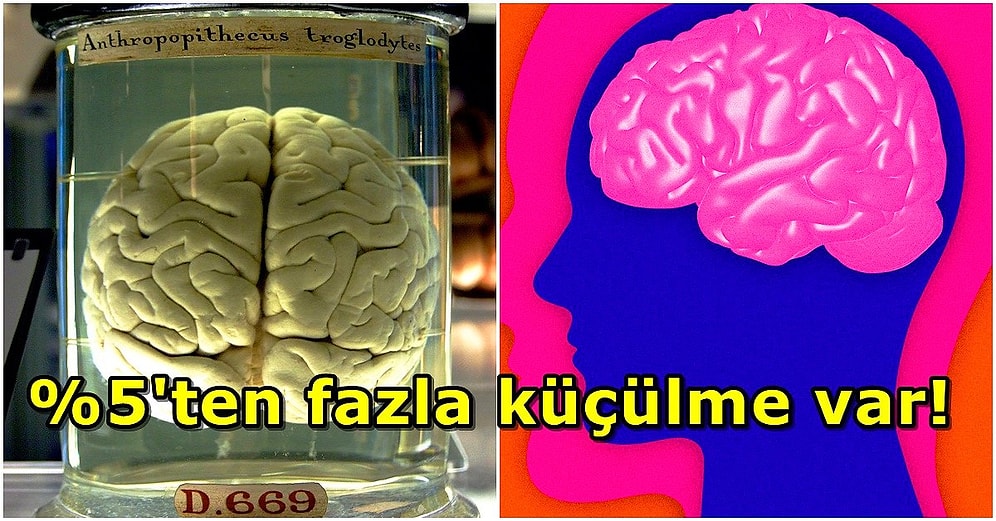 Bilim İnsanları Son 50 Bin Yılda İnsan Beyninin Büyük Ölçüde Küçüldüğünü Açıkladı