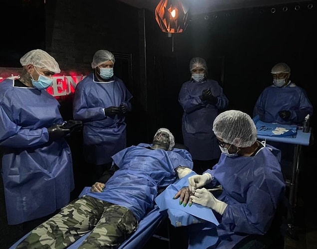 Daha öncelerde benzer ameliyatlar ile insanları şoke eden Loffredo burnunu ve üst dudağını aldırmış, dilinin ortasını kestirmişti.
