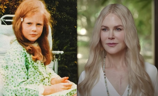 19. Nicole Kidman
