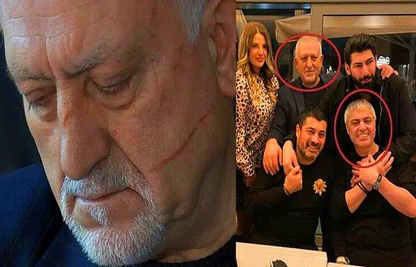 Sarıyer İlçe Emniyet Müdürlüğü ekipleri, Cengiz Kurtoğlu’nu gözaltına aldı. Kurtoğlu poliste verdiği ilk ifadesinde, Mustafa Can’ın Orhan Gencebay ve diğer sanatçılara hakaret ettiği için tartıştığını söyledi.