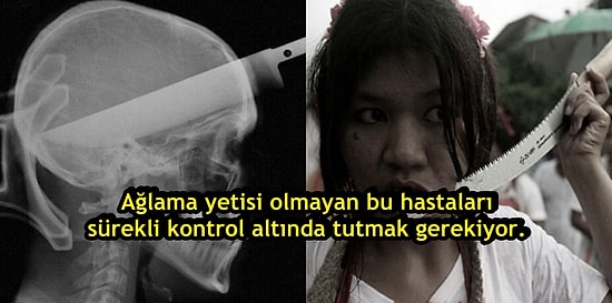 Kafanızın Çekiçle Ezildiğini Ama Acı Hissetmediğinizi Düşünün! Tüm Detaylarıyla Lanet Bir Hastalık Olan: CIPA