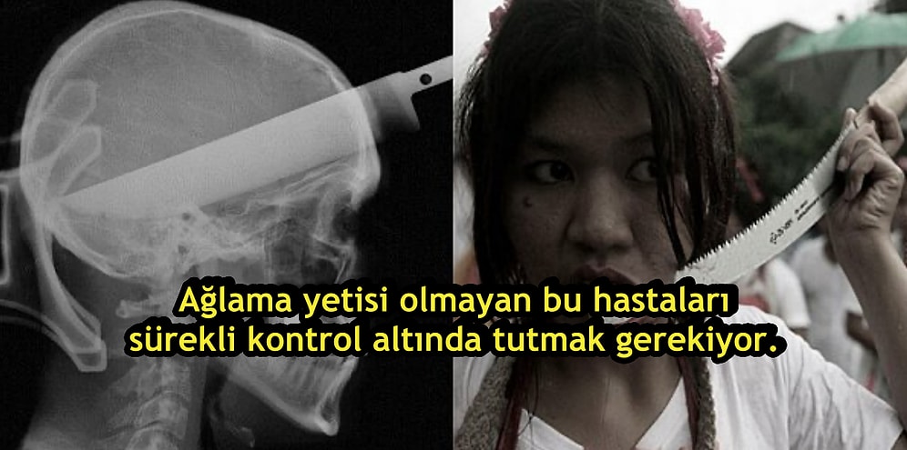 Kafanızın Çekiçle Ezildiğini Ama Acı Hissetmediğinizi Düşünün! Tüm Detaylarıyla Lanet Bir Hastalık Olan: CIPA