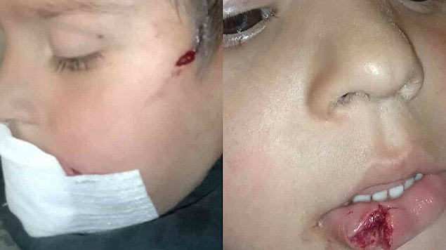 4. Kastamonu’nun Araç ilçesinde arkadaşlarıyla birlikte oyun oynadığı sırada sokak köpeğinin saldırısına uğrayan 3 yaşındaki çocuk, ölümden döndü.