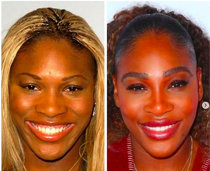 15 новых фотографий, показывающих, как с годами изменились знаменитости (Ну, и без пластики не обошлось)