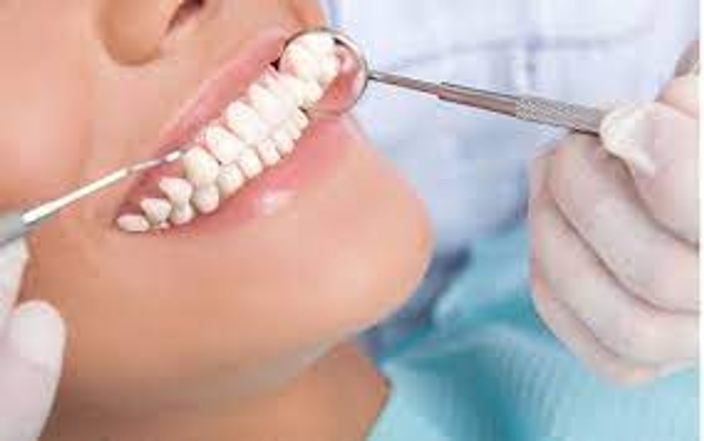 Periodontoloji Nedir? Hangi Hastalıklara Bakar?