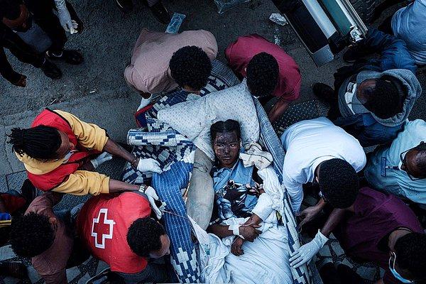 40. Yaralı bir kişi, kuzey Tigray bölgesinde bir pazara yapılan ölümcül hava saldırısından bir gün sonra, 23 Haziran'da Mekele'deki bir hastaneye getiriliyor, Yasuyoshi Chiba.