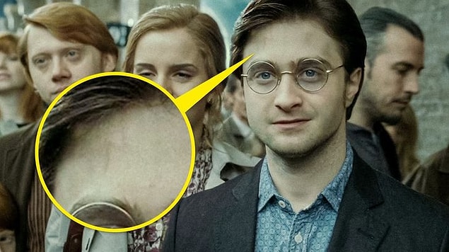 8. Serimizin son sahnelerinde Harry'nın canını yakan o meşhur yaranın artık neredeyse tamamen iyileştiğini gördük.