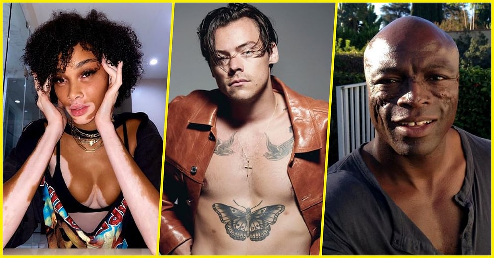 Kimse Kusursuz Değildir! Hollywood Yıldızlarının Daha Önce Hiç Duymadığınız Farklı Fiziksel Özellikleri