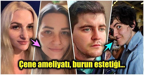 Bambaşka Biri OImuşlar! Öncesi ve Sonrası Fotoğraflarıyla Soğuk Duş Almış Etkisi Yaratan 19 Estetik Mucizesi