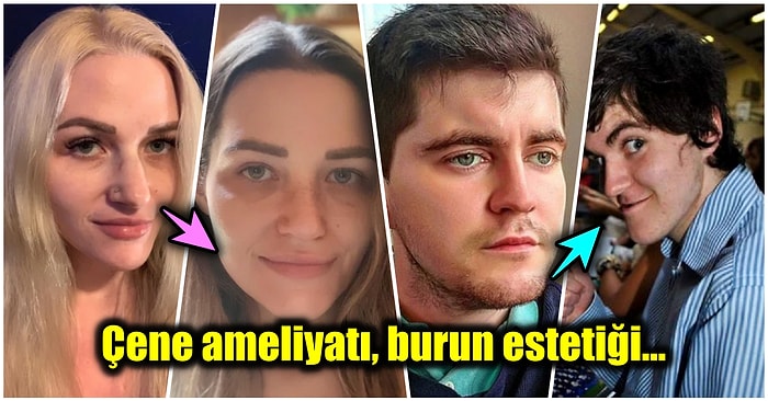 Bambaşka Biri OImuşlar! Öncesi ve Sonrası Fotoğraflarıyla Soğuk Duş Almış Etkisi Yaratan 19 Estetik Mucizesi