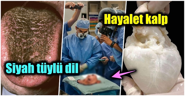 ‘Doktorlar’ Dizisine Taş Çıkaracak Birbirinden İlginç Bu Tıbbi Vakaları Görünce Hayatınızı Sorgulayacaksınız!