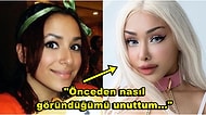 Doğal Güzellik Timsali! Estetiğe Milyonlar Harcadıktan Sonra Dolgularını Eritmeye Karar Veren OnlyFans Modeli