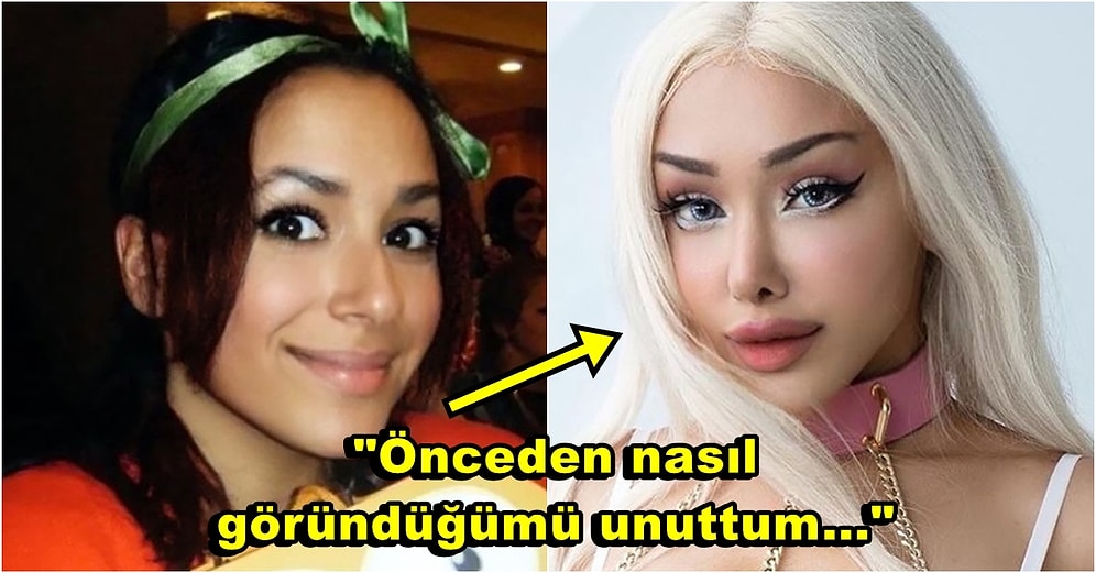 Doğal Güzellik Timsali! Estetiğe Milyonlar Harcadıktan Sonra Dolgularını Eritmeye Karar Veren OnlyFans Modeli