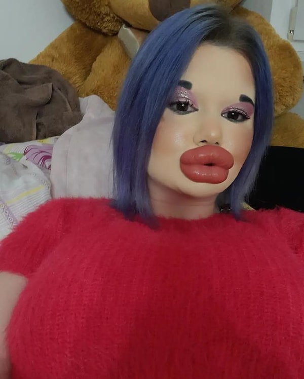 Болгарка заявила, что любит свои губы и чувствует с ними себя лучше.