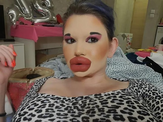 Женщина с самыми большими губами в мире, не собирается останавливаться и планирует увеличить щеки