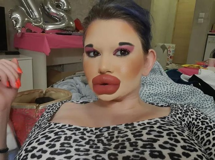 Женщина с самыми большими губами в мире, не собирается останавливаться и планирует увеличить щеки